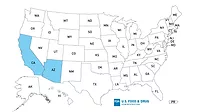 OutbreakSalmonofSalmonellaDistributionMap_1170x658.jpg