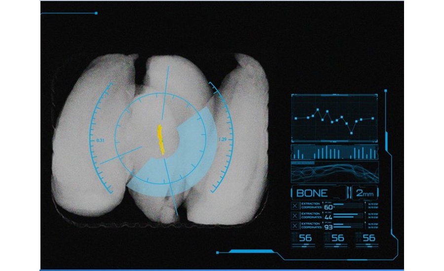 Dual-Energy-DXD-Inspection-of-Chicken_900x550.jpg