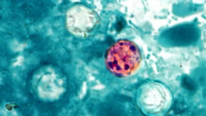 Cyclospora
