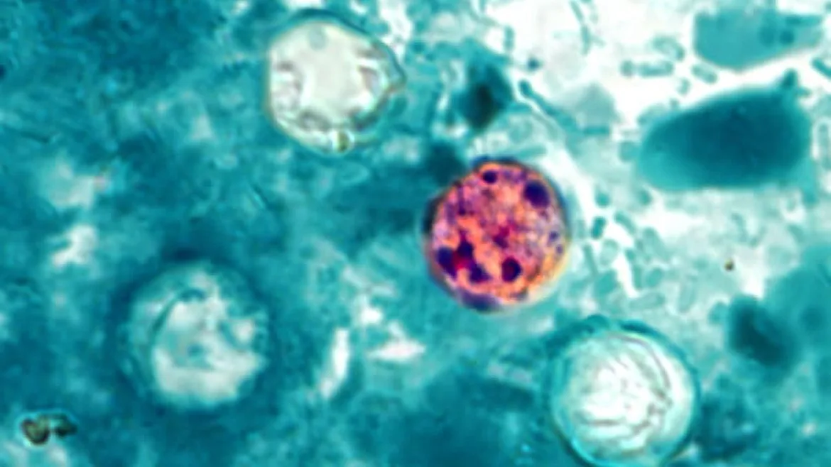 Cyclospora