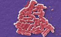 E. coli outbreaks shake up Chipotle, Costco