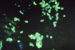 E. coli photomicrograph